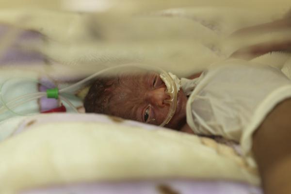 A newborn baby rests in an incubator