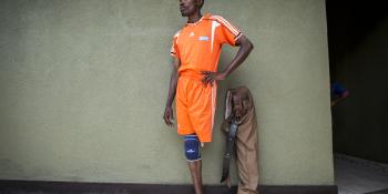 Living with a disability in Rwanda Living with a disability in Rwanda