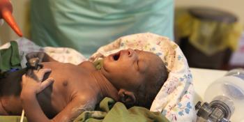 Newborn baby in Uganda Newborn baby in Uganda